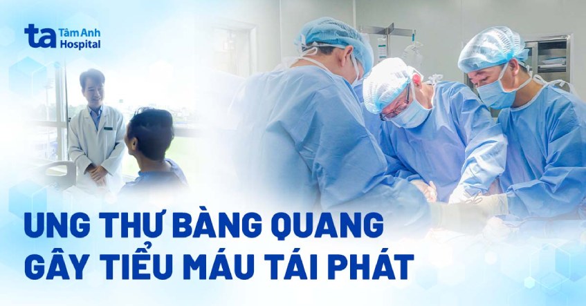 ung thư bàng quang gây tiểu máu tái phát nhiều lần