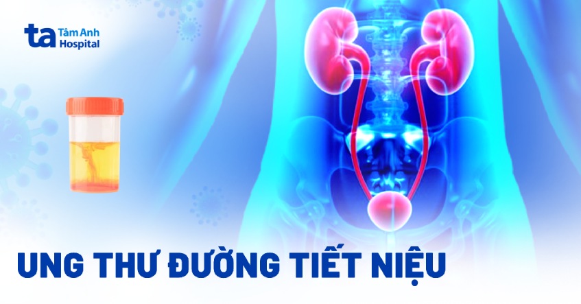 ung thư đường tiết niệu