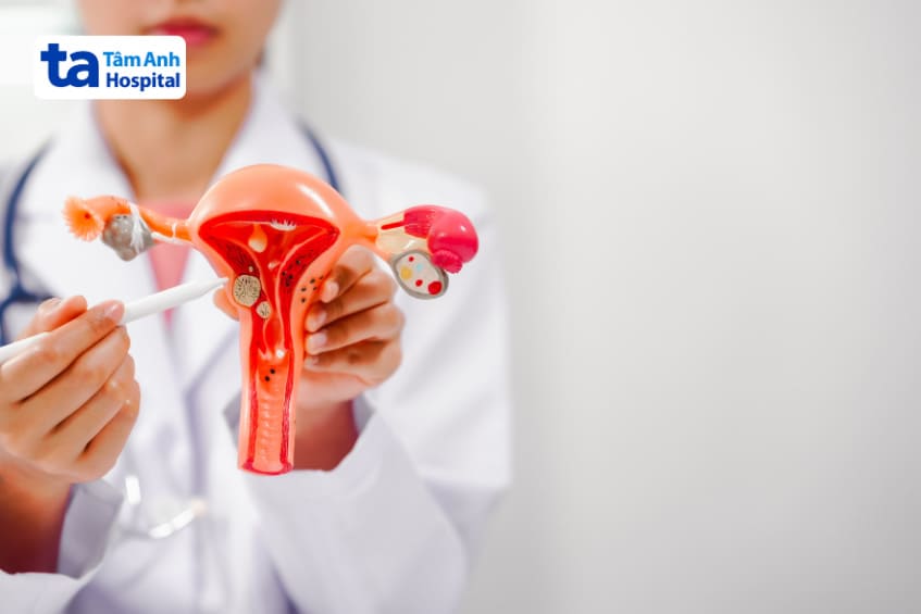 Ung thư nội mạc tử cung là một căn bệnh nguy hiểm