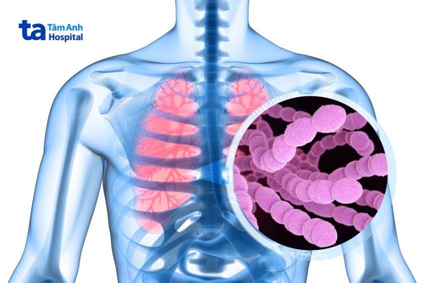 Vắc xin Prevenar 13 có tác dụng phòng bệnh gì?