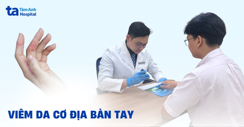 viêm da cơ địa ở tay