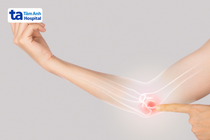 x quang khuỷu tay