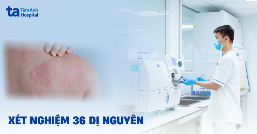Xét nghiệm 36 dị nguyên bao nhiêu tiền? Khi nào nên lựa chọn?