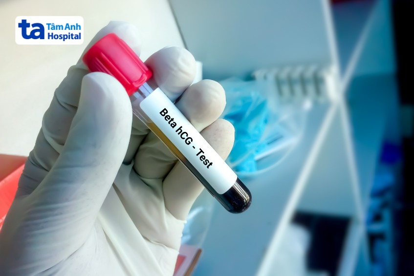 xét nghiệm hcg