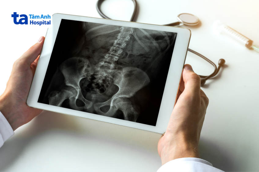 Xét nghiệm hình ảnh chẩn đón đau khớp háng