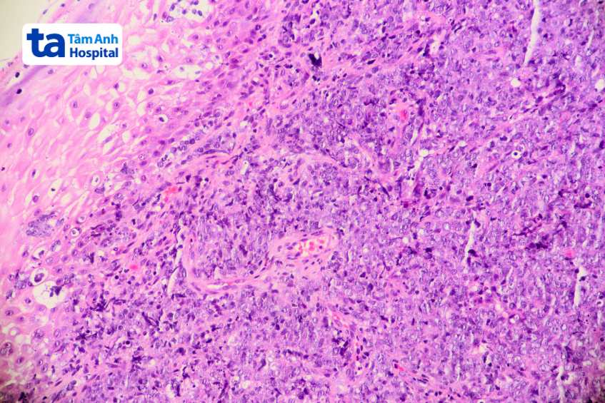 xét nghiệm máu kiểm tra tế bào b