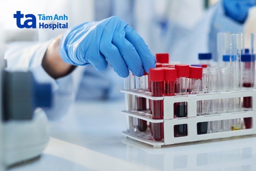 xét nghiệm máu tổng quát giúp phát hiện sớm