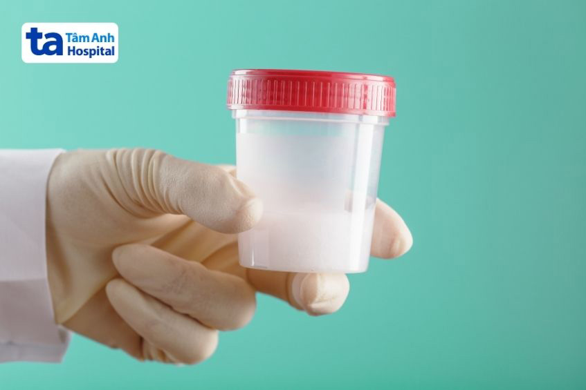 Xét nghiệm tinh dịch đồ giúp nhận biết dấu hiệu bất thường