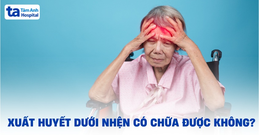 Xuất huyết dưới nhện có chữa được không? Yếu tố nào ảnh hưởng?