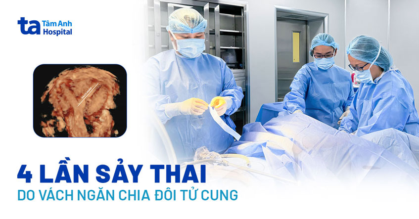 4 lần bị sảy thai