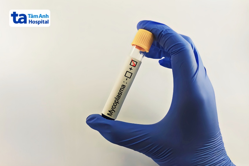 bác sĩ chẩn đoán chứng nhiễm khuẩn Mycoplasma