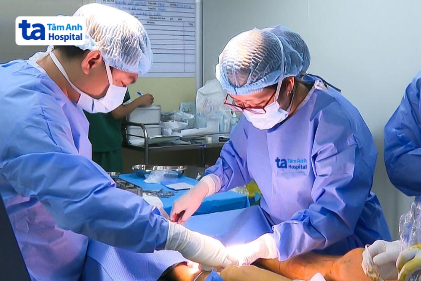 Bác sĩ đốt laser tĩnh mạch điều trị suy tĩnh mạch chi dưới cho bệnh nhân