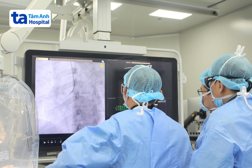 Bác sĩ tại BVĐK Tâm Anh thực hiện đặt stent graft cho bệnh nhân