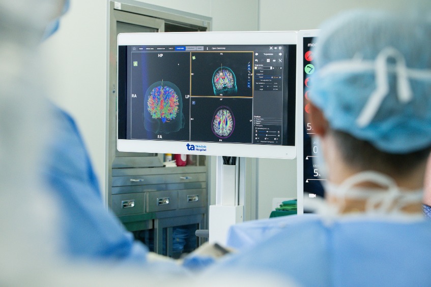 bác sĩ theo dõi hình ảnh toàn bộ cấu trúc não trong mổ não bằng robot ai