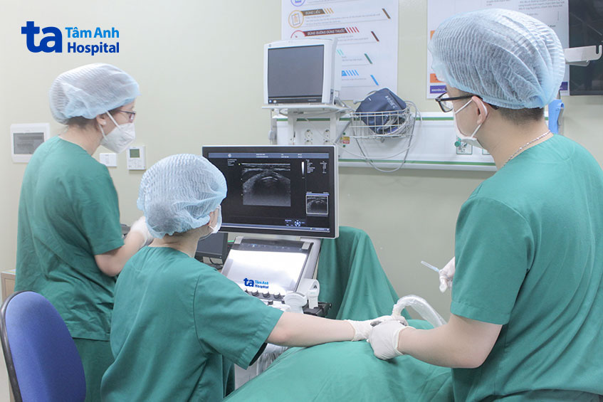 Bác sĩ tiến hành phương pháp đốt sóng cao tần RFA triệt tiêu bướu giáp nhỏ lành tính