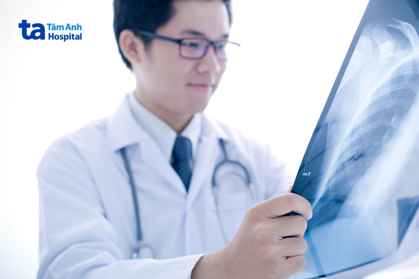 bác sĩ xem ảnh x quang phổi