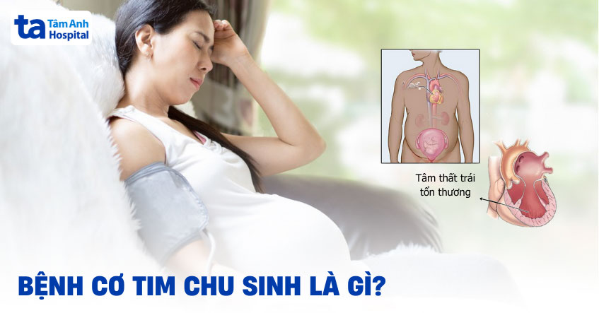 Bệnh cơ tim chu sinh: Nguyên nhân, triệu chứng và chẩn đoán
