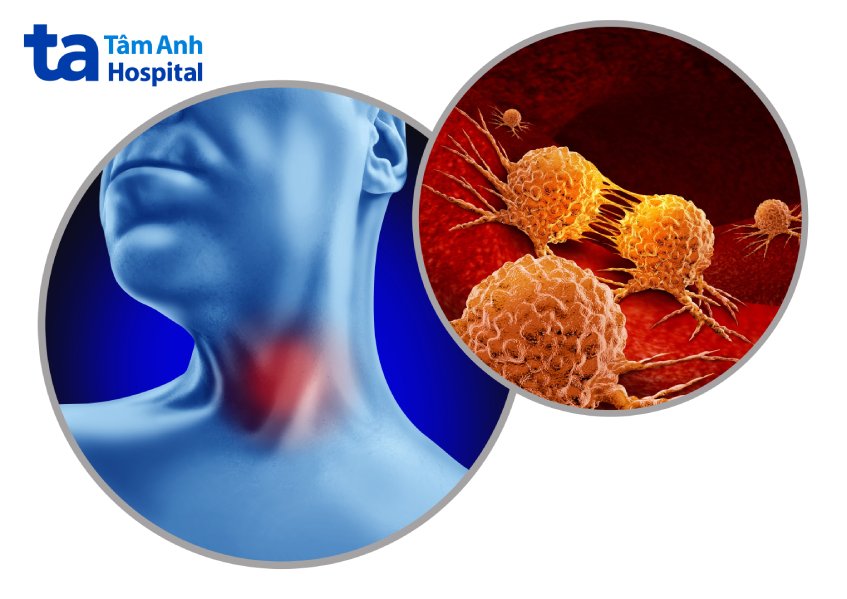 bệnh lý về họng