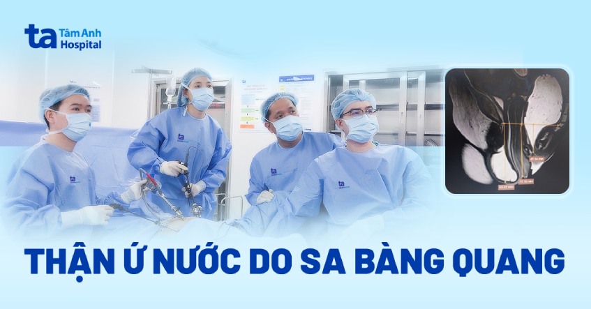 Thận ứ nước do sa bàng quang