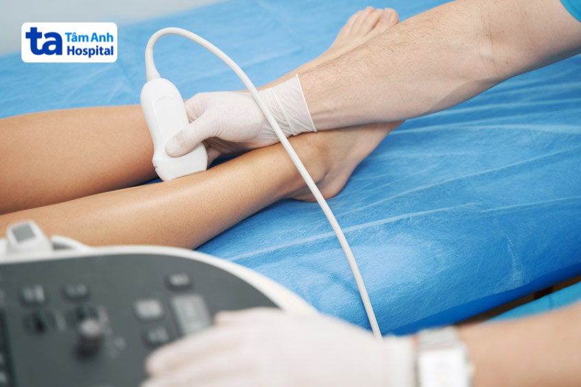 Bệnh nhân được chẩn đoán bằng kỹ thuật siêu âm tĩnh mạch chi dưới