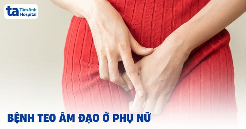 Bệnh teo âm đạo ở phụ nữ