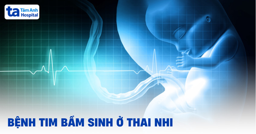 Bệnh tim bẩm sinh ở thai nhi: Nguyên nhân, dấu hiệu và chẩn đoán