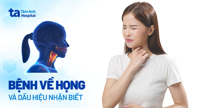 6 bệnh về họng thường gặp hiện nay: Dấu hiệu và cách phòng ngừa