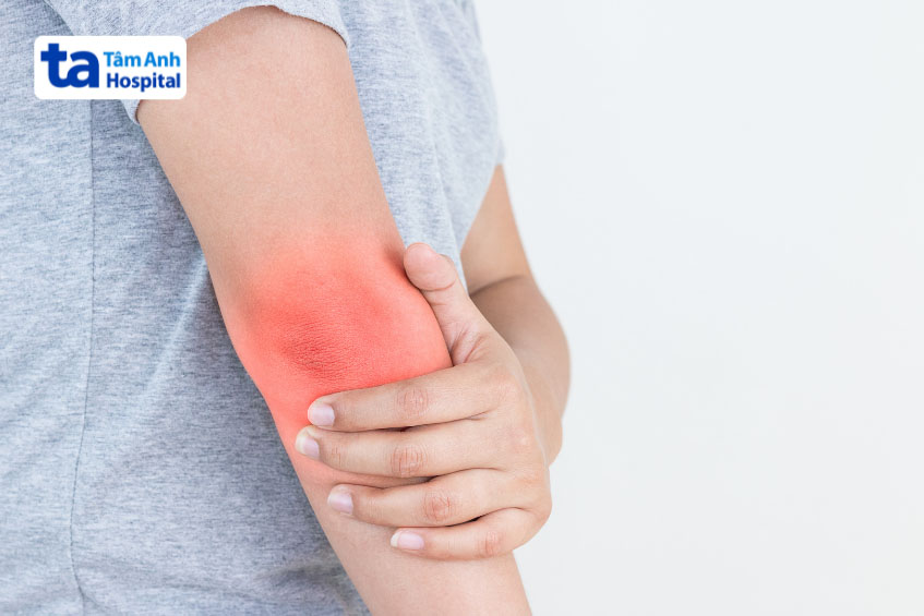 Bị cứng khớp khủy tay là gì