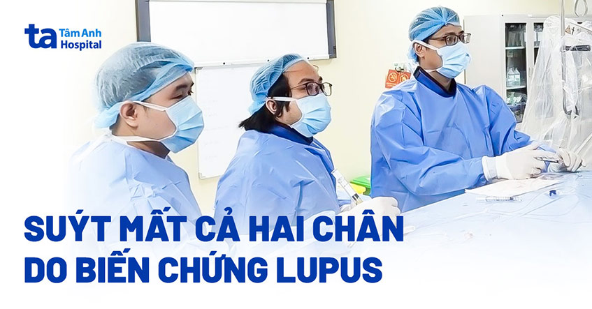 Biến chứng lupus khiến cụ bà suýt mất cả hai chân