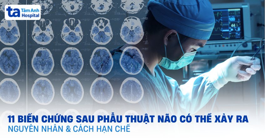 11 biến chứng sau phẫu thuật não có thể gặp và cách khắc phục