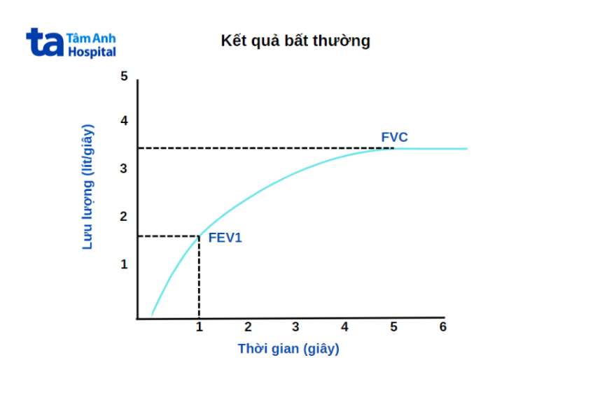 Biểu đồ đo chức năng hô hấp có kết quả bất thường