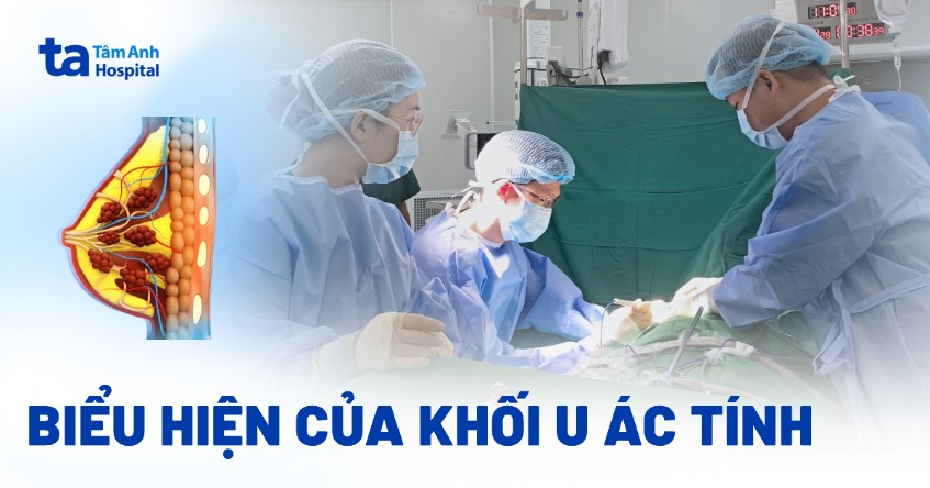 Arab katta dumba rasmlar Polsha etuklar porno