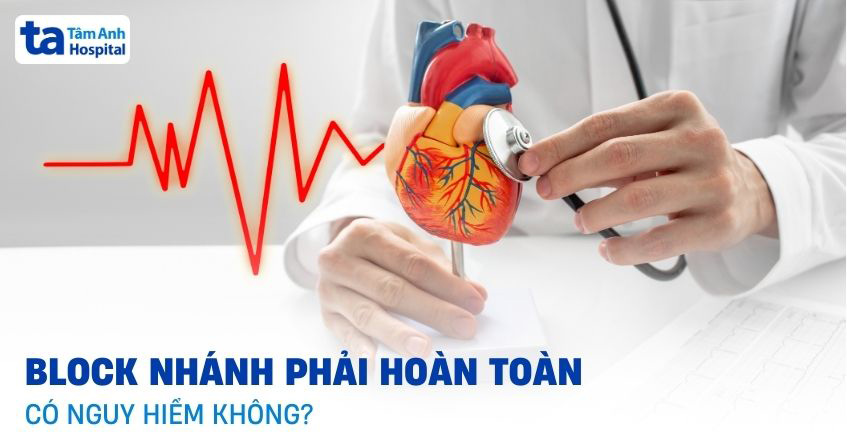 Block nhánh phải hoàn toàn là gì? Có nguy hiểm không?