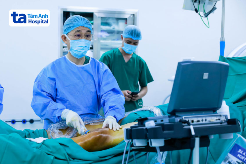 Bơm keo sinh học điều trị giãn tĩnh mạch tại BVĐK Tâm Anh TP.HCM
