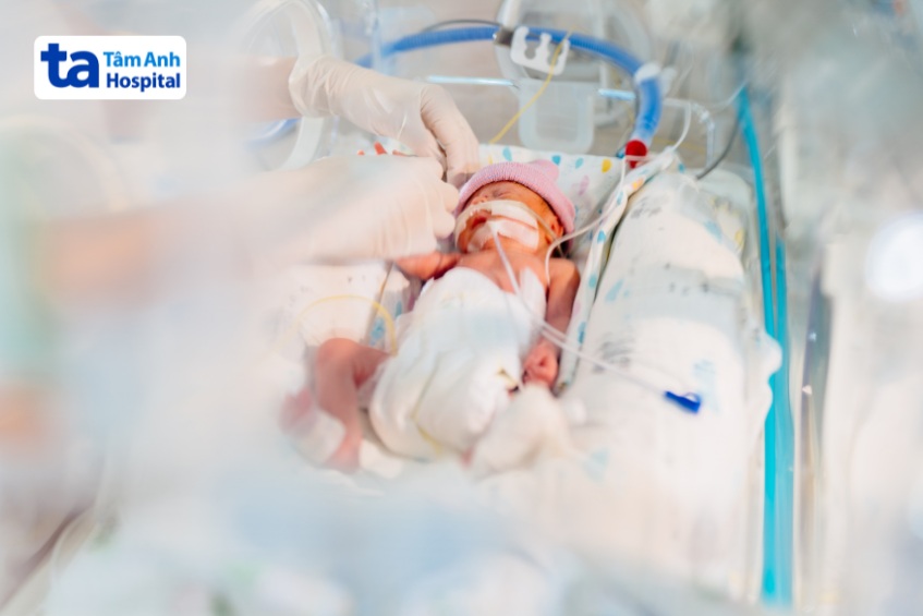 Bơm Surfactant là kỹ thuật phổ biến trong điều trị suy hô hấp