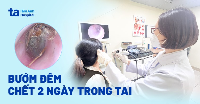 bướm đêm chui vô tai