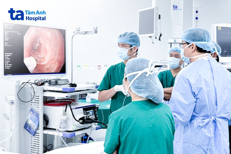 ca chữa co thắt tâm vị