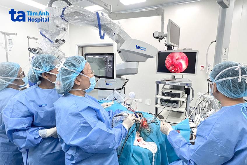 ca phẫu thuật có kính hiển vi