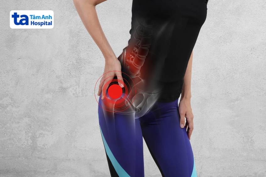 Các triệu chứng gây thoái hóa khớp háng ở người trẻ