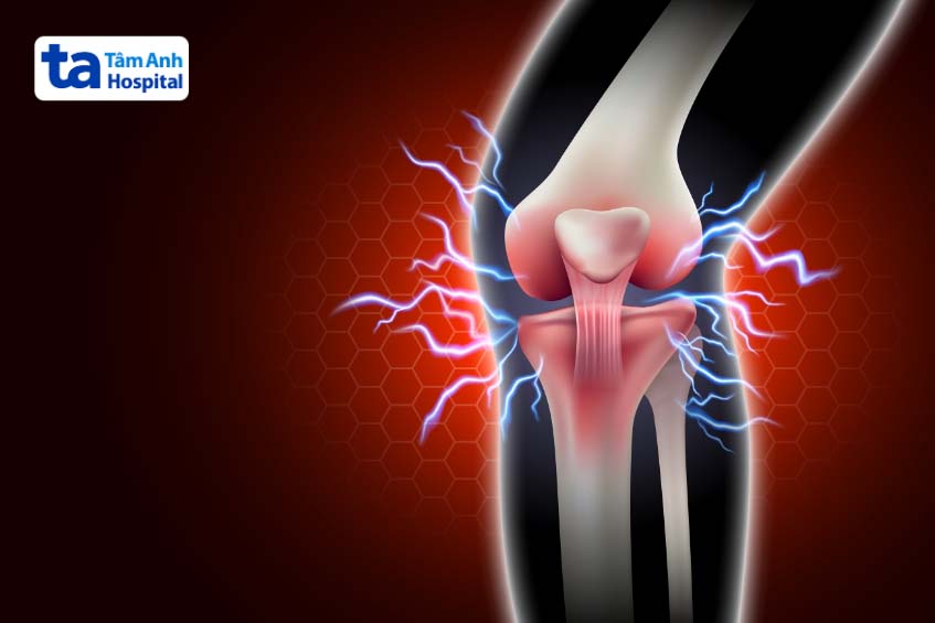 các vấn đề thường gặp về chất lỏng hoạt dịch