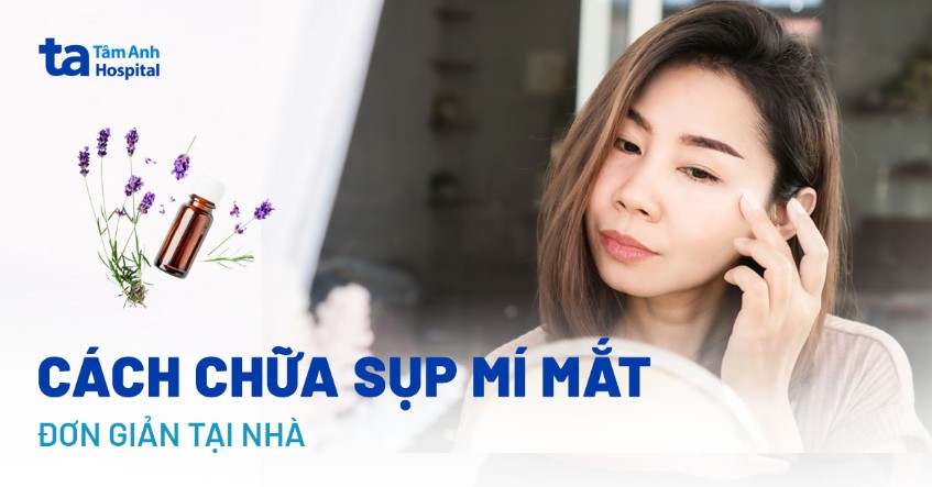 5 cách chữa sụp mí mắt đơn giản tại nhà giúp người bệnh mau hồi phục