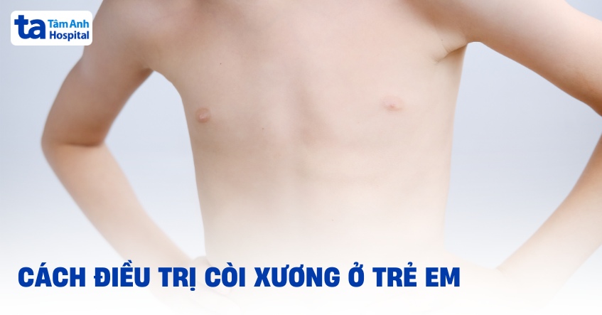 5 cách điều trị còi xương ở trẻ em giúp khắc phục bệnh hiệu quả