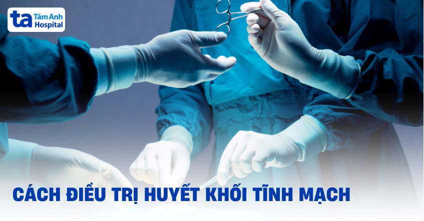 5 cách điều trị huyết khối tĩnh mạch mang lại hiệu quả cao