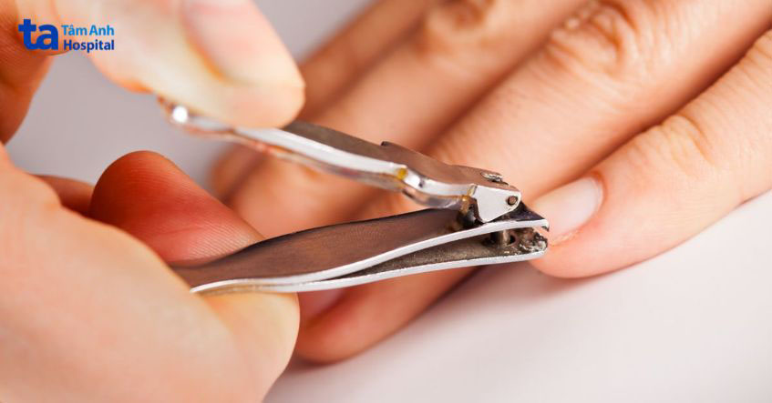 cách phòng tránh nấm da