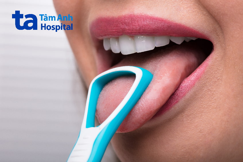 Chăm sóc răng miệng tại nhà giúp ngăn ngừa sâu răng