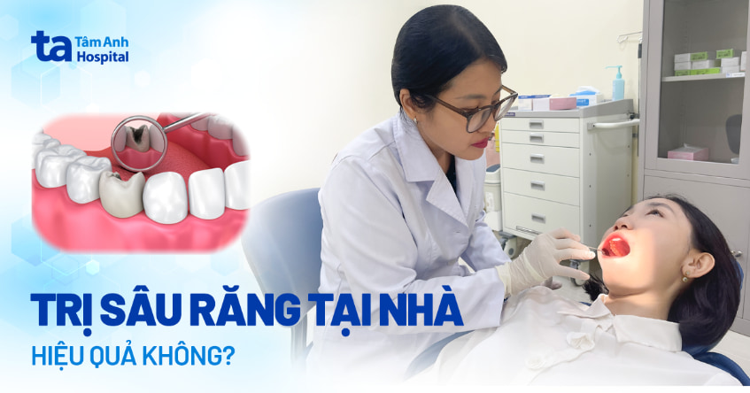 Cách trị sâu răng tại nhà: Hiệu quả không, lưu ý và hậu quả