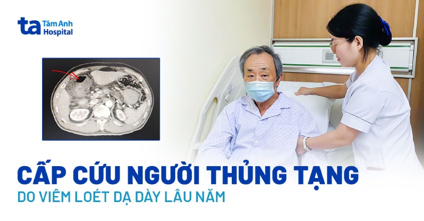 cấp cứu người thủng tạng