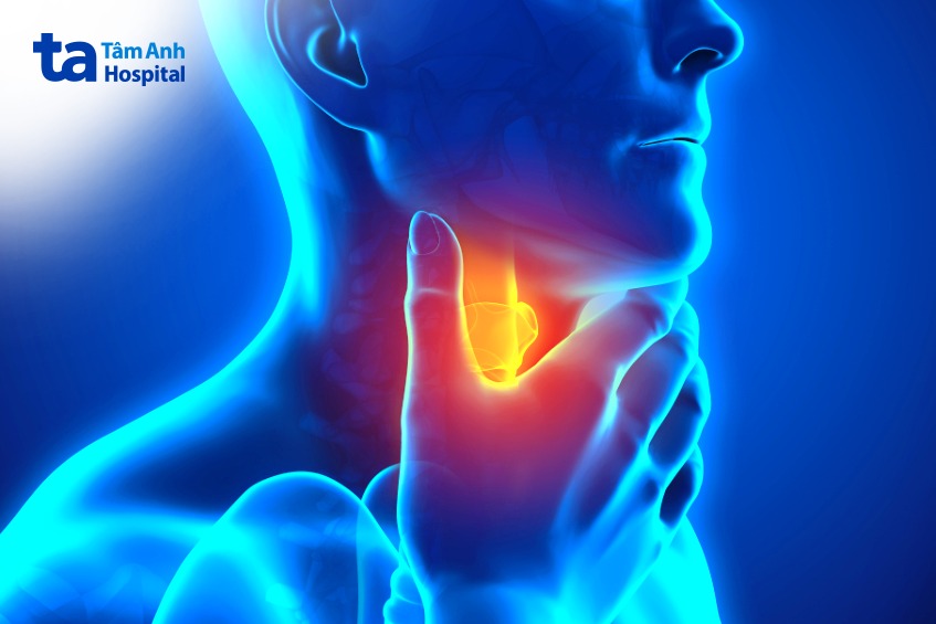 cắt polyp thanh quản có ảnh hưởng không