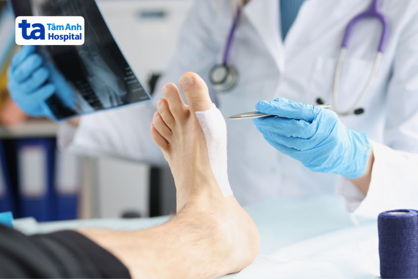 chẩn đoán nguyên nhân bị đau khớp ngón chân cái