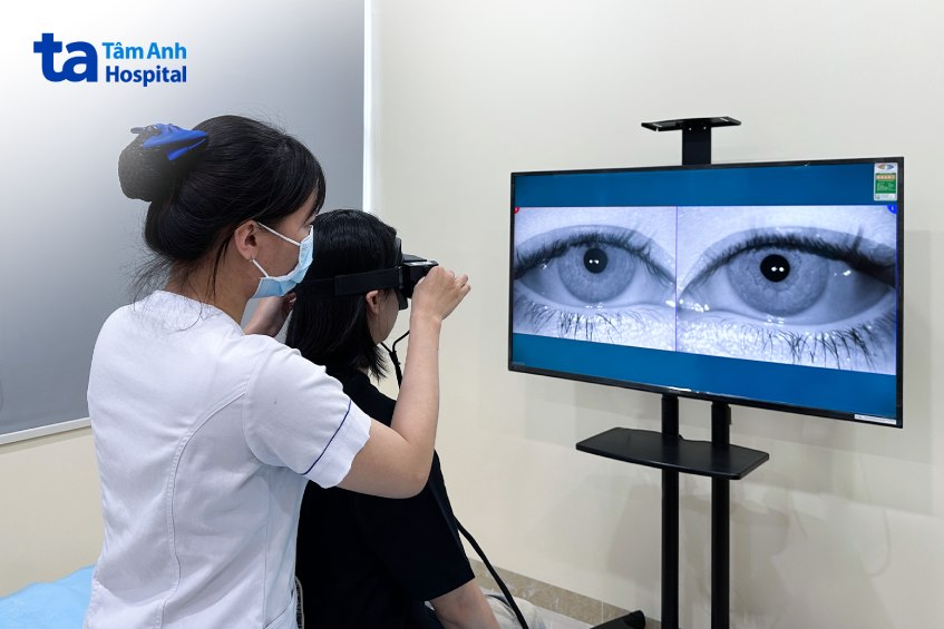 check vận động mắt